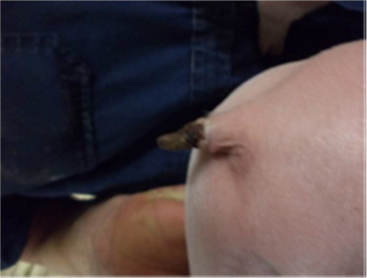 Figura 1: necrosi della coda in un suinetto di 5 settimane di et&agrave;